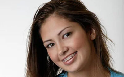 Helpful Hygiene Tips For Patients Who Wear Braces