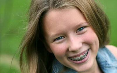 How To Avoid Delays During Your Orthodontic Treatment