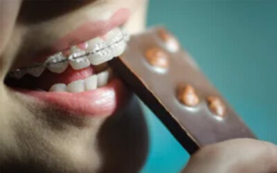 How To Enjoy A Halloween Treat Without Harming Your Braces