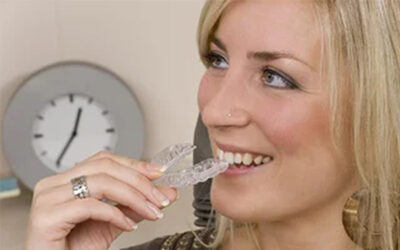 Invisalign® Q&A