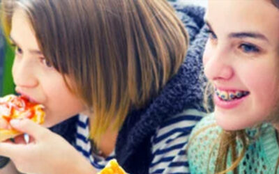 Making Healthy And Braces-Friendly Choices