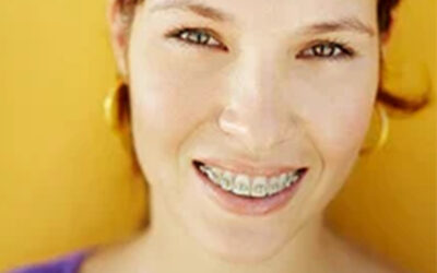 What Should I Ask During My Orthodontic Consultation?