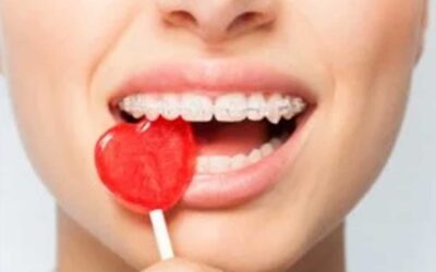 3 Halloween Braces Myths