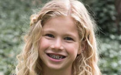 Benefits Of Interceptive Treatment For Children
