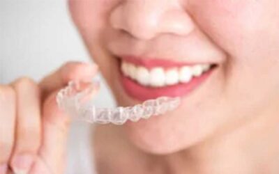 Celebrating The Dental Innovation, Invisalign®!