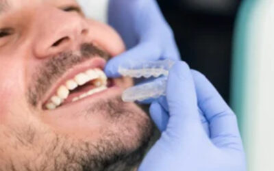 Never Too Late: Orthodontic Options For Adults