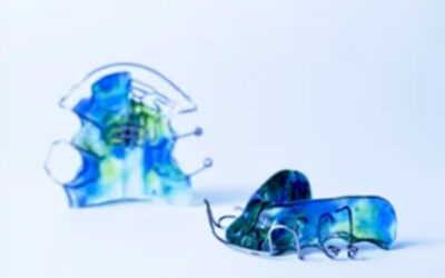 Tips & Tricks To Remember To Wear Your Retainer