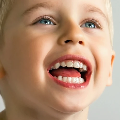 Non-Braces Treatment
