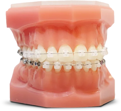 Damon Smile for Adults