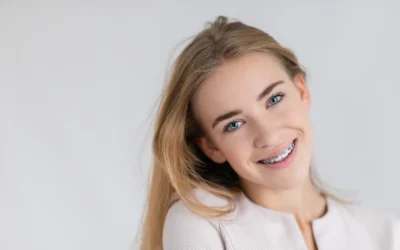Braces for Teens: Navigating the Journey to a Perfect Smile