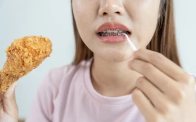 What lifestyle changes do I have to make with braces?