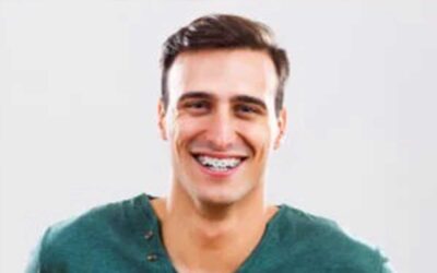April Fools! Busting Braces Myths