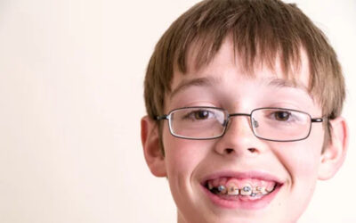 Early Orthodontics