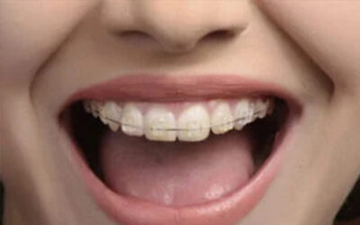 Five New Year’s Resolutions For A Healthy Mouth