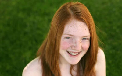 Helpful Hints For Dealing With Braces Pain