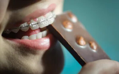 Keep That Candy At Bay During Your Treatment!