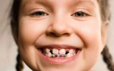 National Children’s Dental Health Month