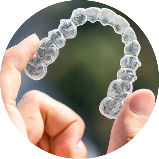 What are the differences between Clear Braces vs Invisalign Aligners?
