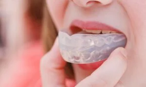 Person putting in a mouthguard